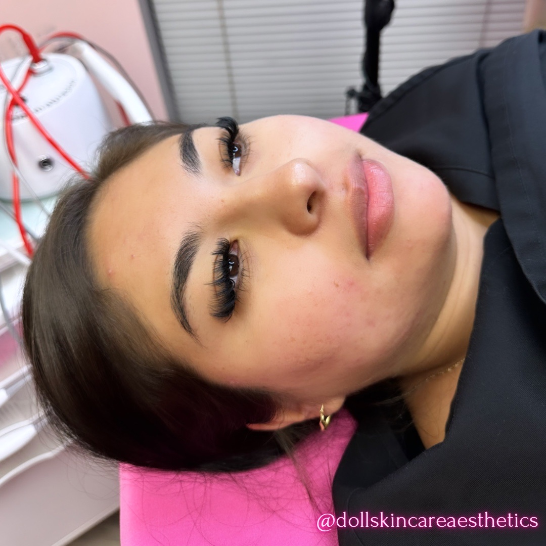 Doll Skincare And Aesthetics In San Diego CA